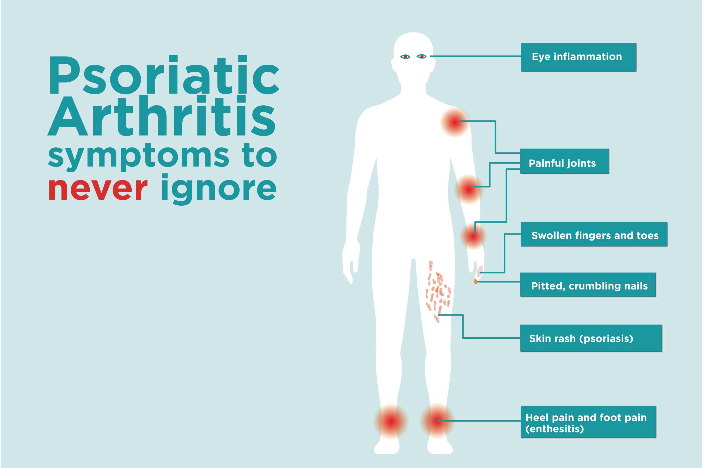 Let's Take A Look At The Strange Symptoms of Psoriatic Arthritis