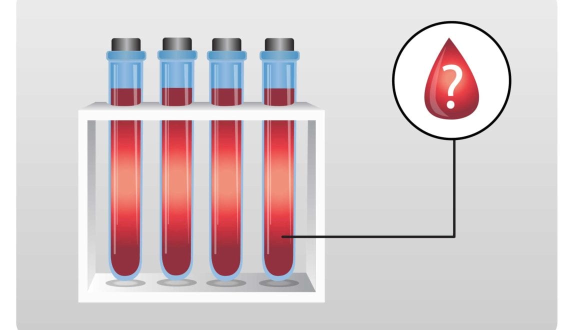 Seronegative Rheumatoid Arthritis