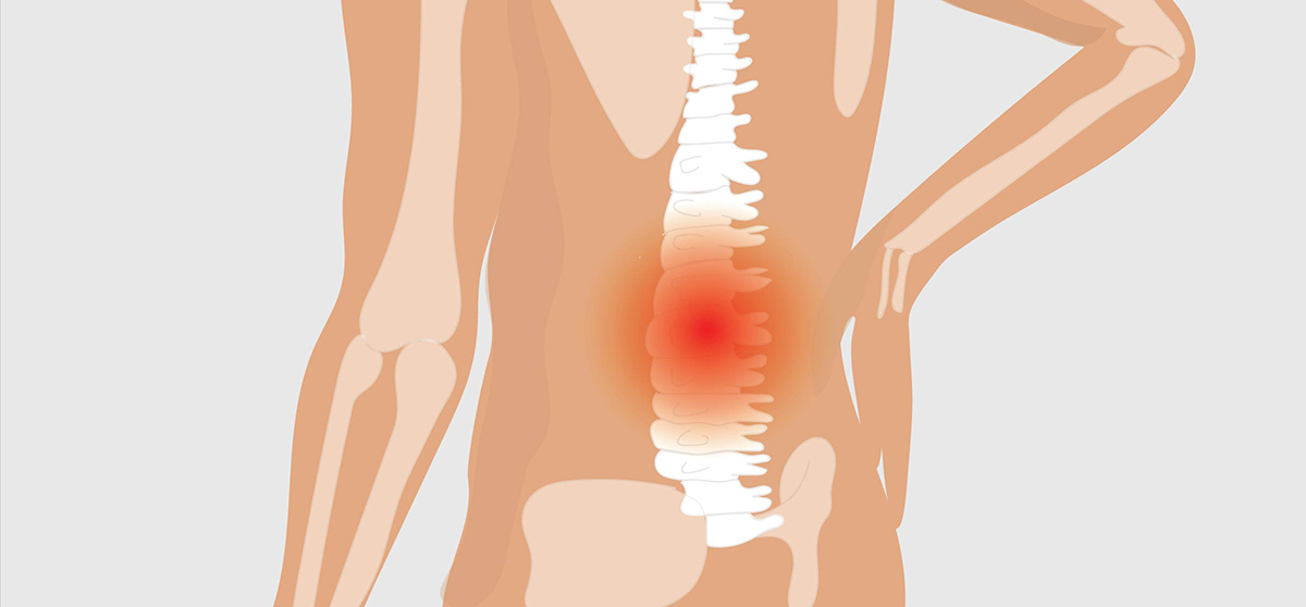 Ankylosing Spondylitis in the Spine