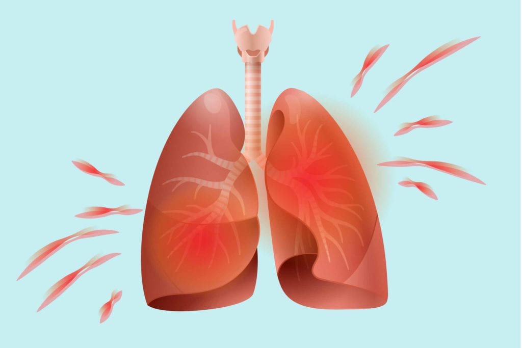 Can Rheumatoid Arthritis Affect The Heart And Lungs