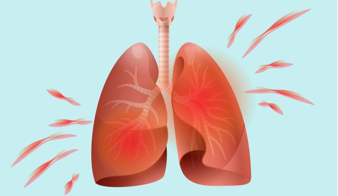 How Arthritis Affects the Lungs