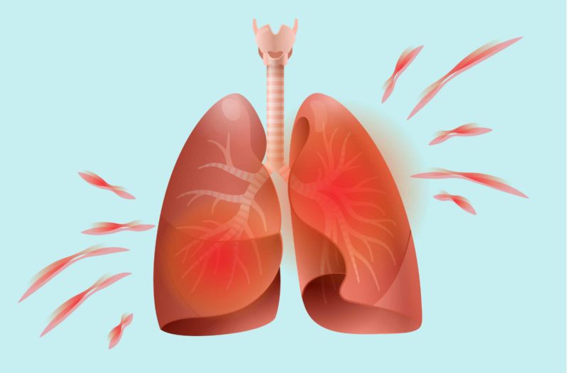 How Arthritis Affects the Lungs