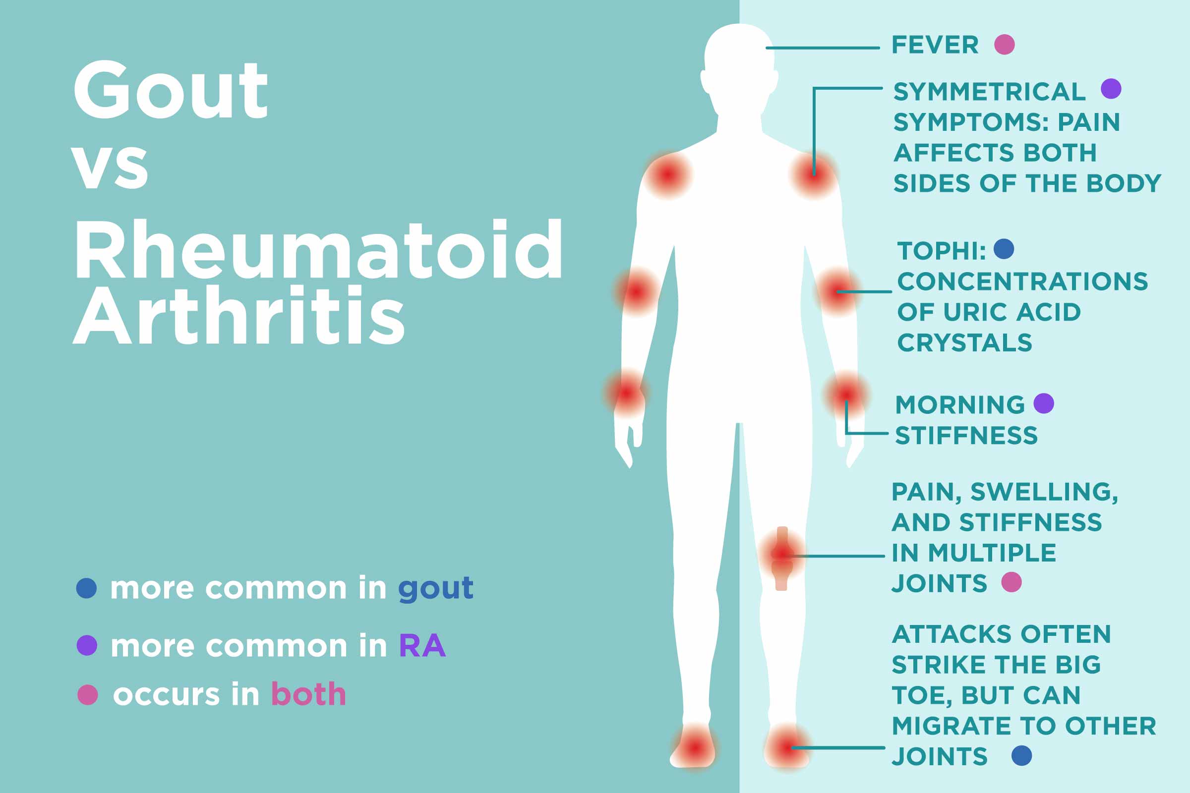 gout-vs-rheumatoid-arthritis-what-s-the-difference