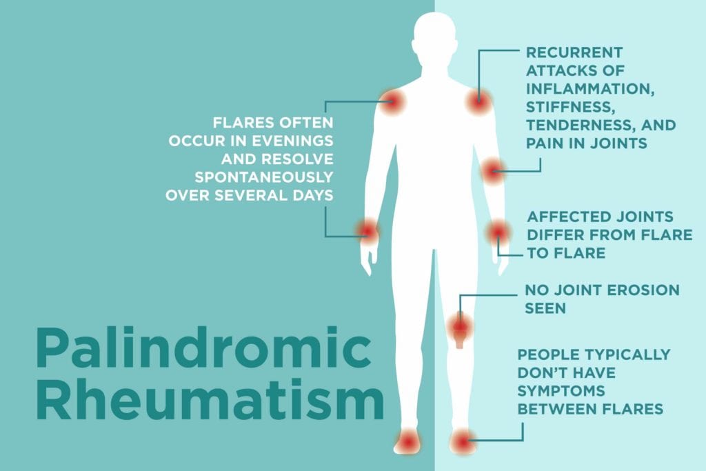 What Is Palindromic Rheumatism