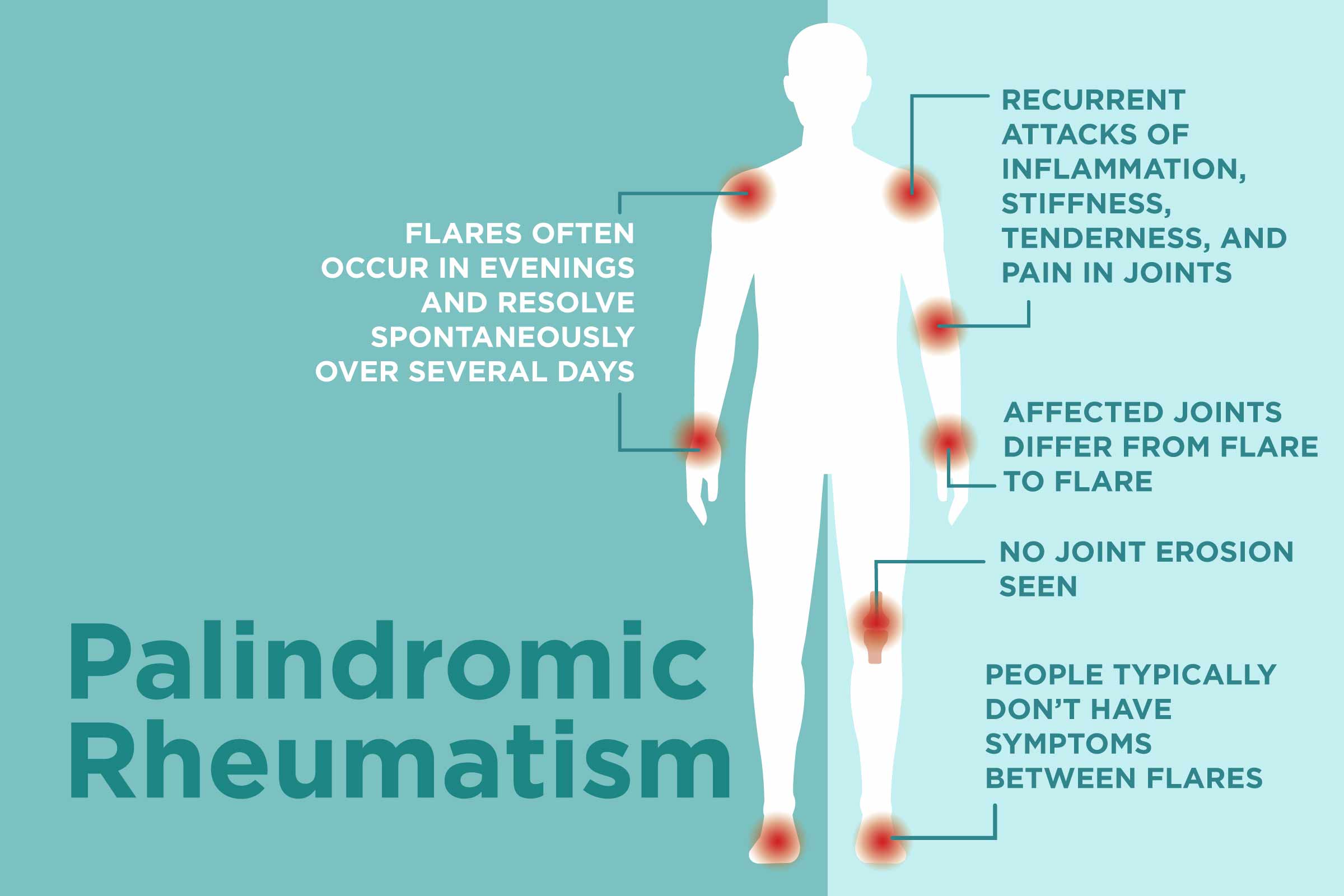 What Is Palindromic Rheumatism?