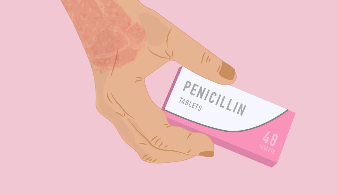 Penicillin Allergy