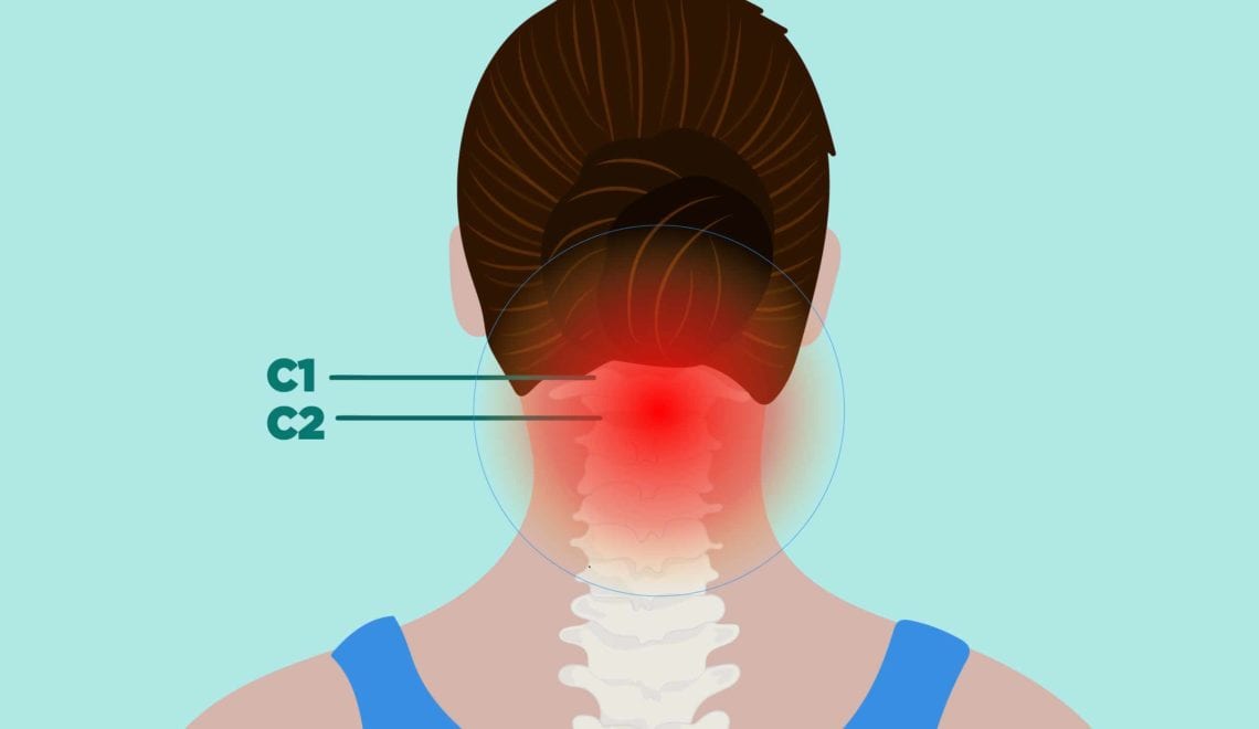 Back Pain in Rheumatoid Arthritis