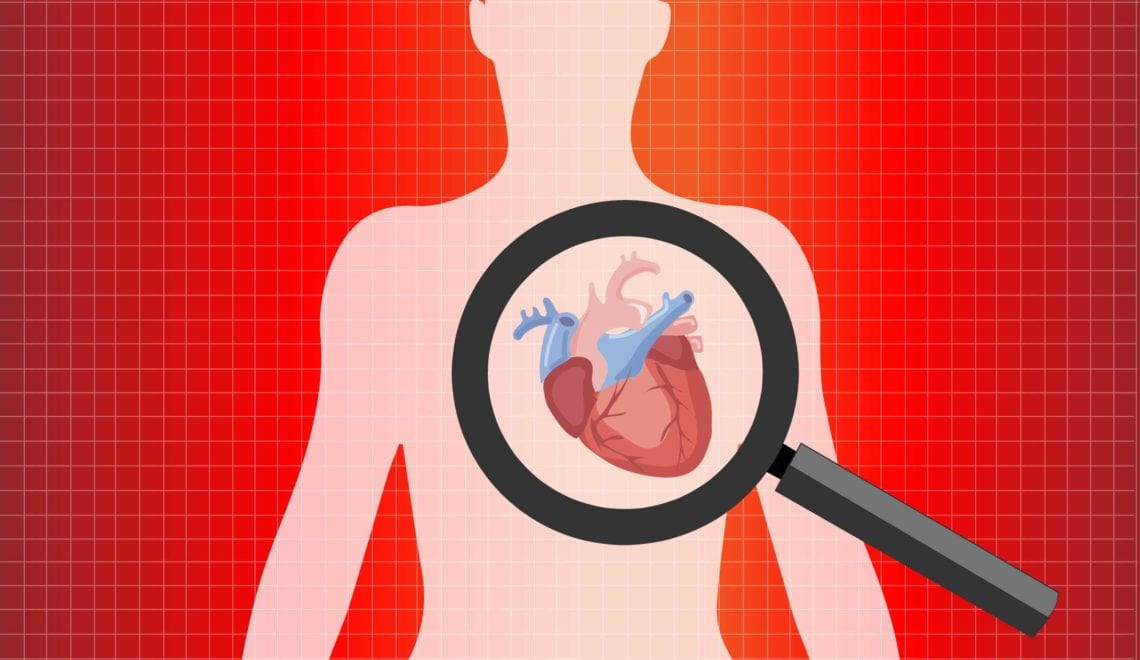 Rheumatoid Arthritis and Heart Disease