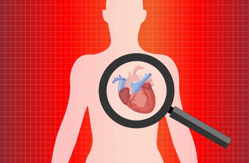 Rheumatoid Arthritis and Heart Disease