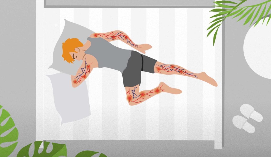 Not Getting Enough Sleep Is Bad for Arteries