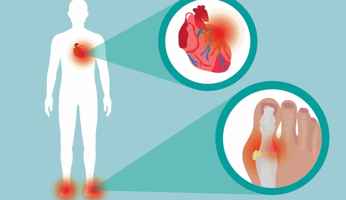 cartoon shows an image of a person with pain in the heart and the feet. There is a zoomed-in image of the heart and a zoomed-in image of gout in the toe joints