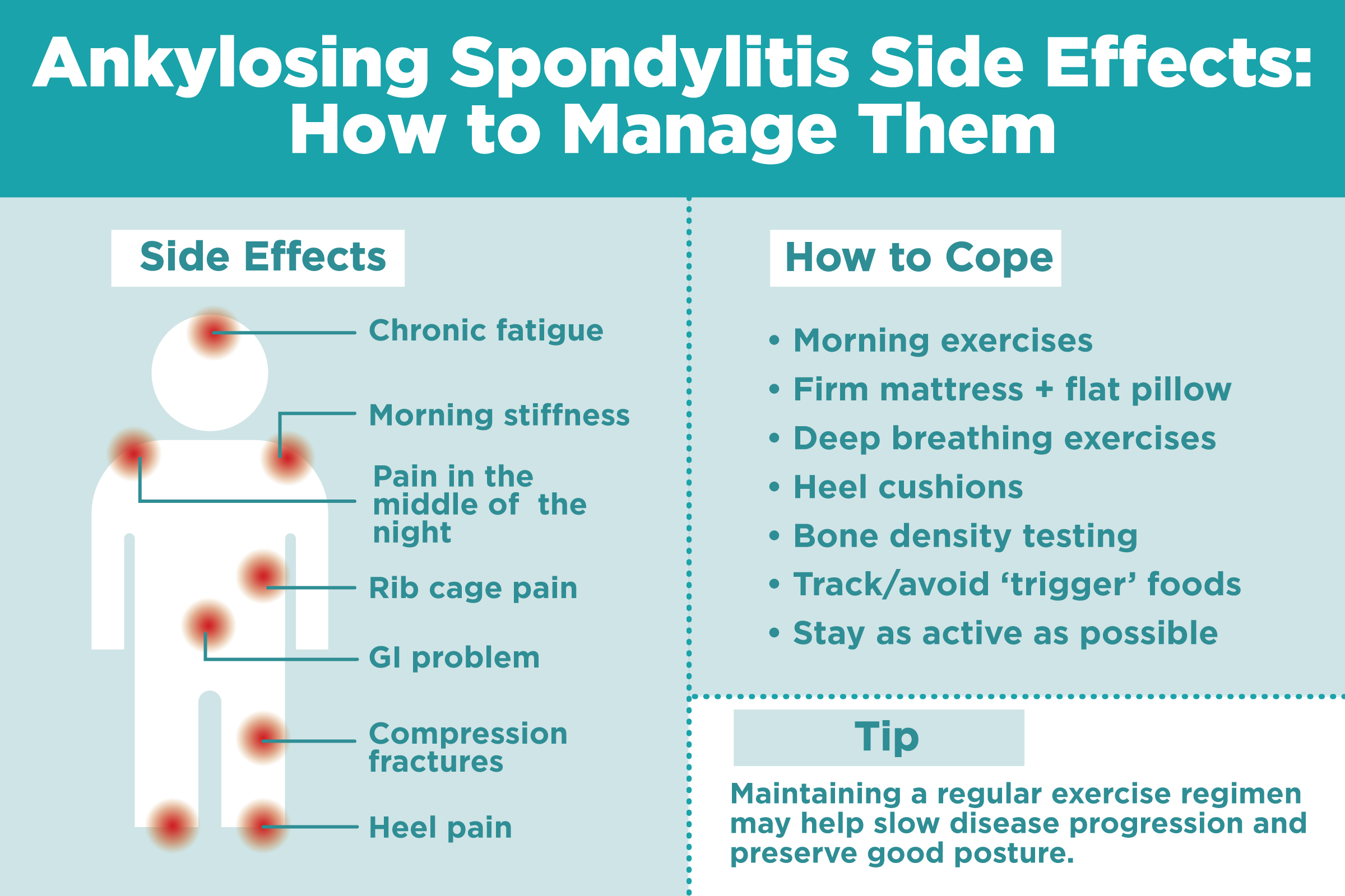 Ankylosing Spondylitis Chart