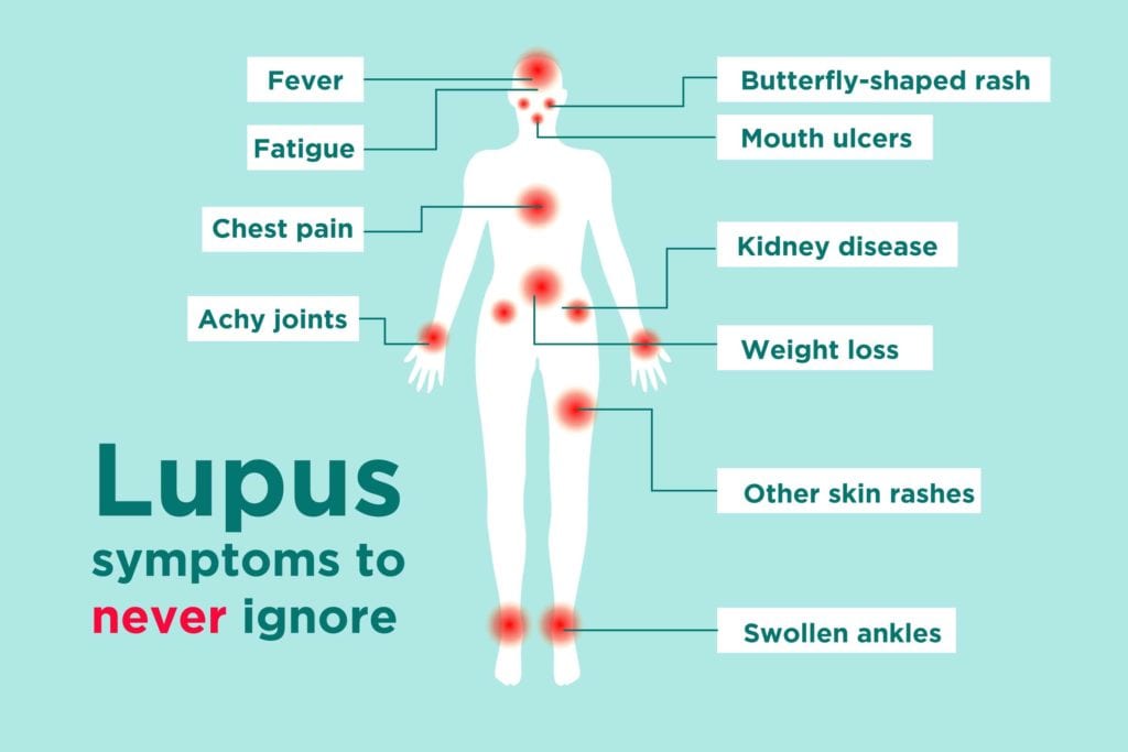 Lupus Signs and Symptoms: How to Tell If You Could Have Lupus