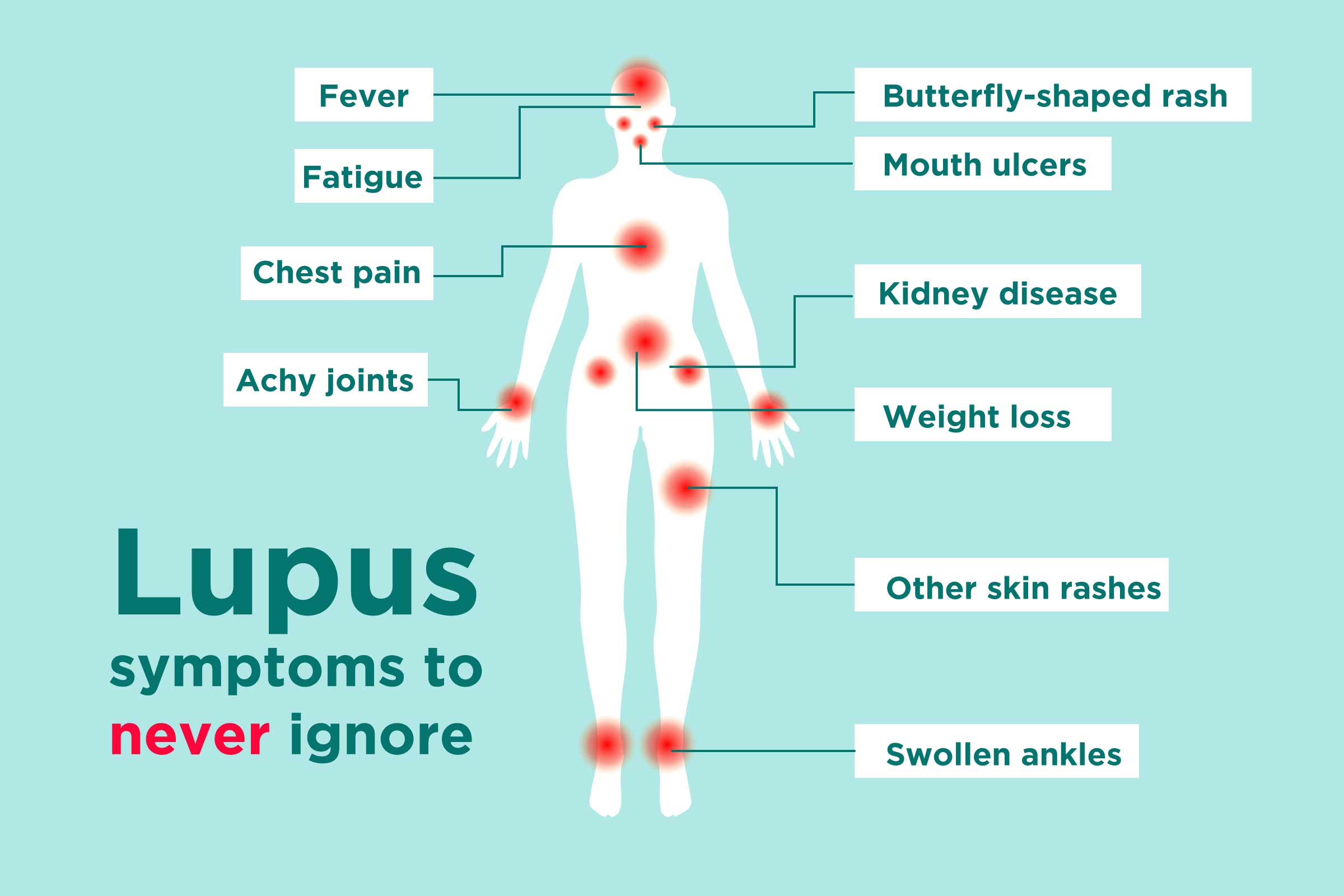 Eye Conditions Associated With Lupus