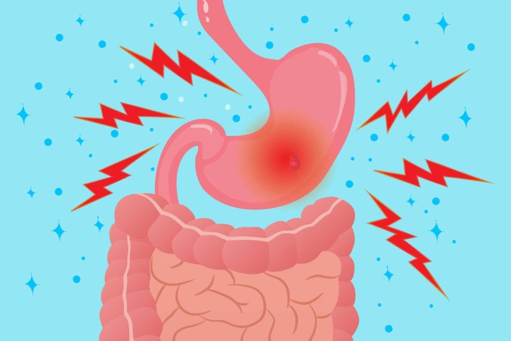 Is acid reflux and gastritis the same thing