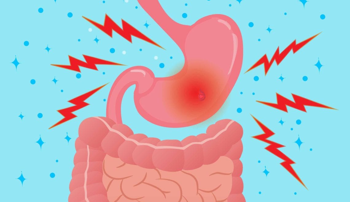 cartoon shows a stomach with red indicating pain