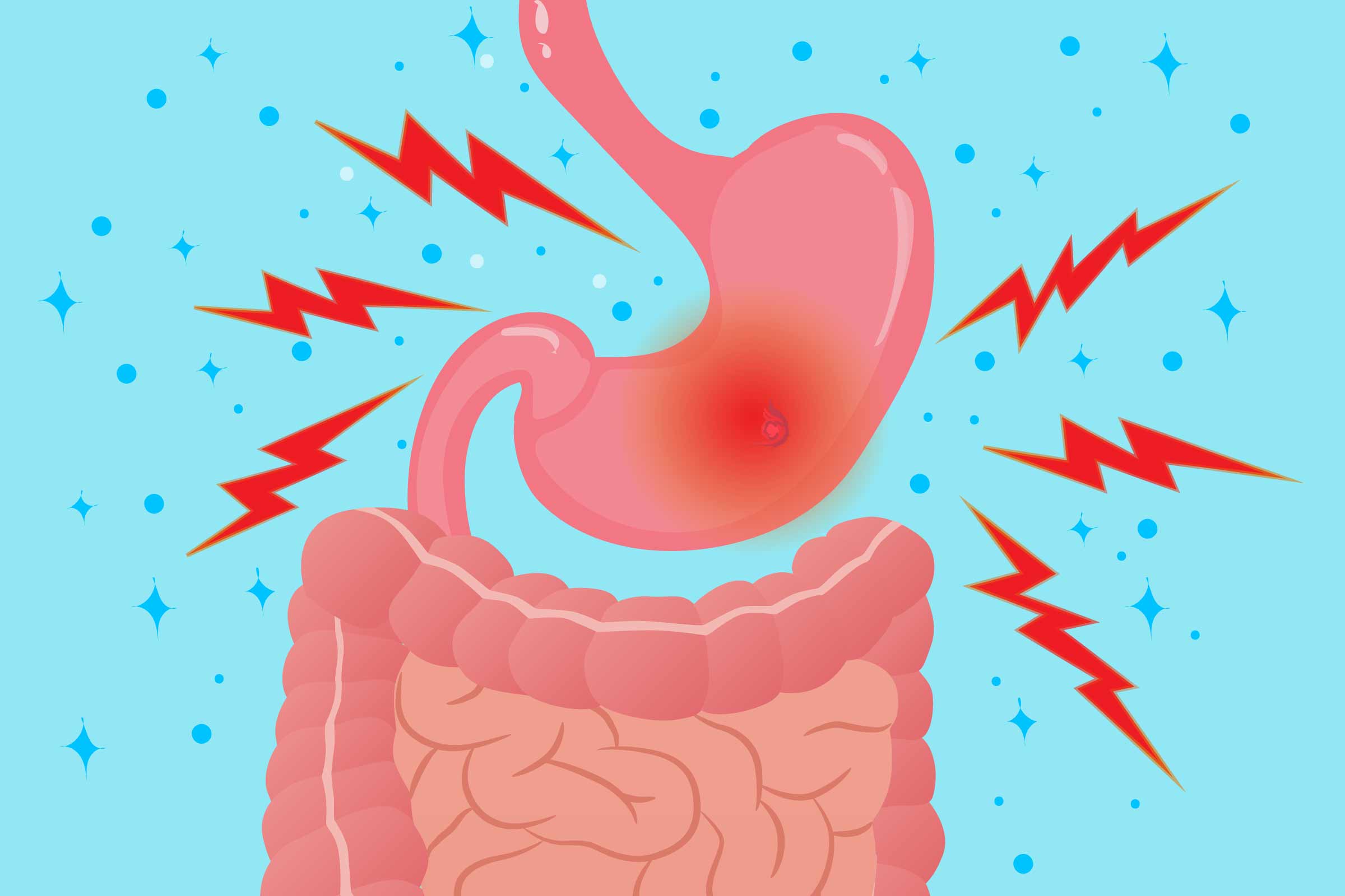 NSAIDs and Gastrointestinal Side Effects: What Patients Need to Know