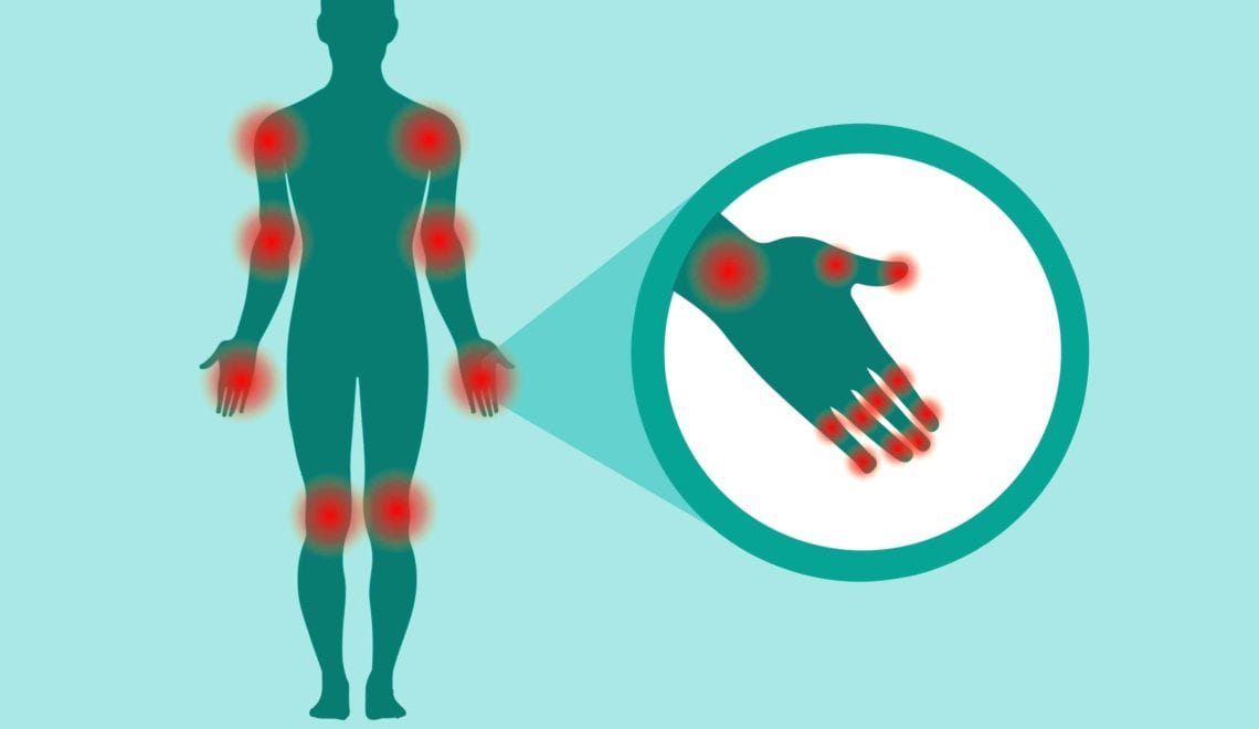 Tender Joint Count for Arthritis