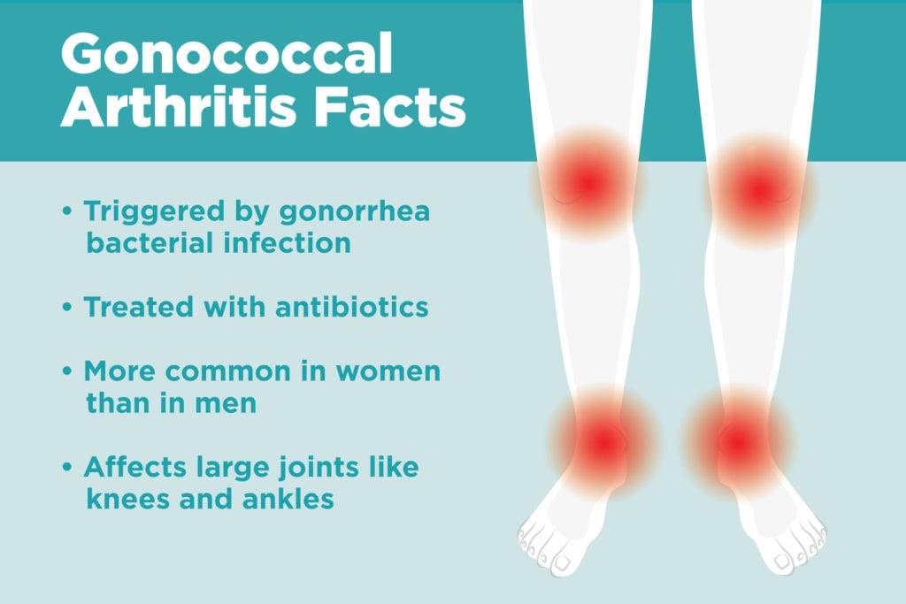 Septic Arthritis Knee Gonorrhea