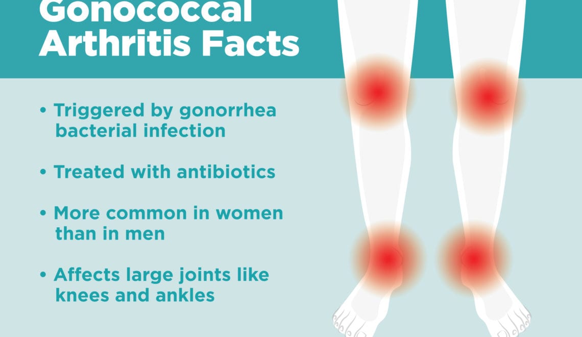 Gonococcal Arthritis