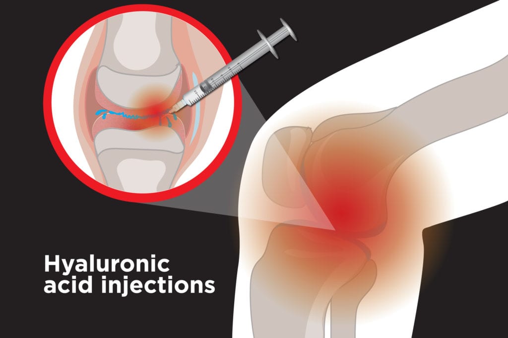 Cure for arthritis in knees