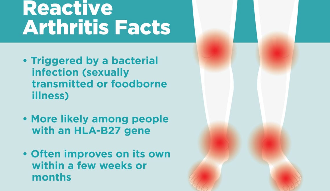 Reactive Arthritis Infographic