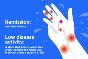 Image shows hands with joint pain and reads: Remission: inactive disease Low disease activity: A state that keeps symptoms under control and helps you maintain a good quality of life