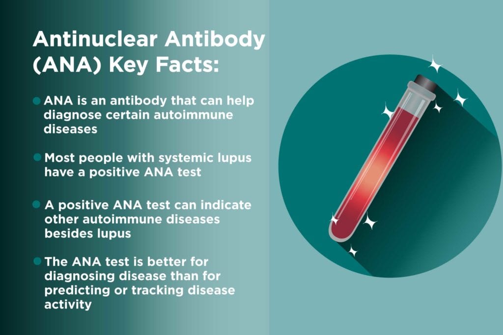 antibody screen negative