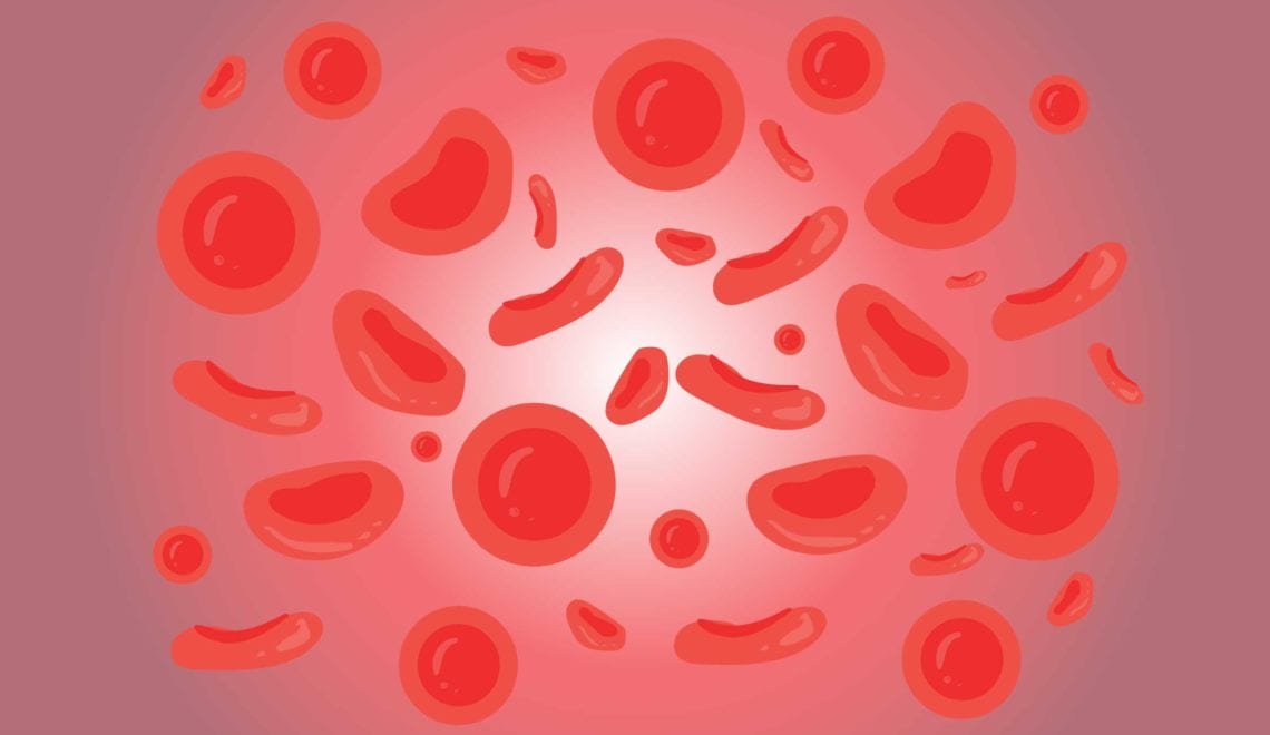 Anemia and Rheumatoid Arthritis