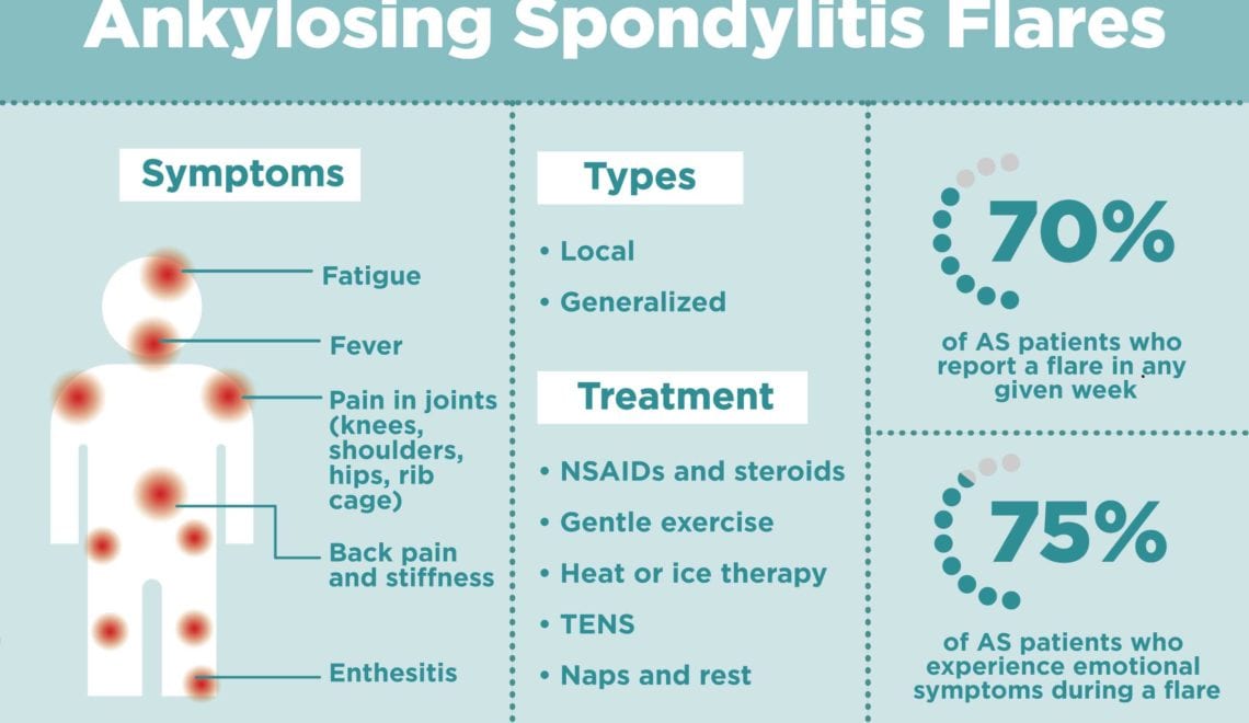 Ankylosing Spondylitis Flares Infographic