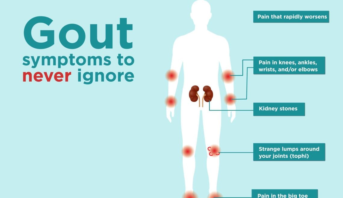 Illustration showing the different gout symptoms areas on a human body