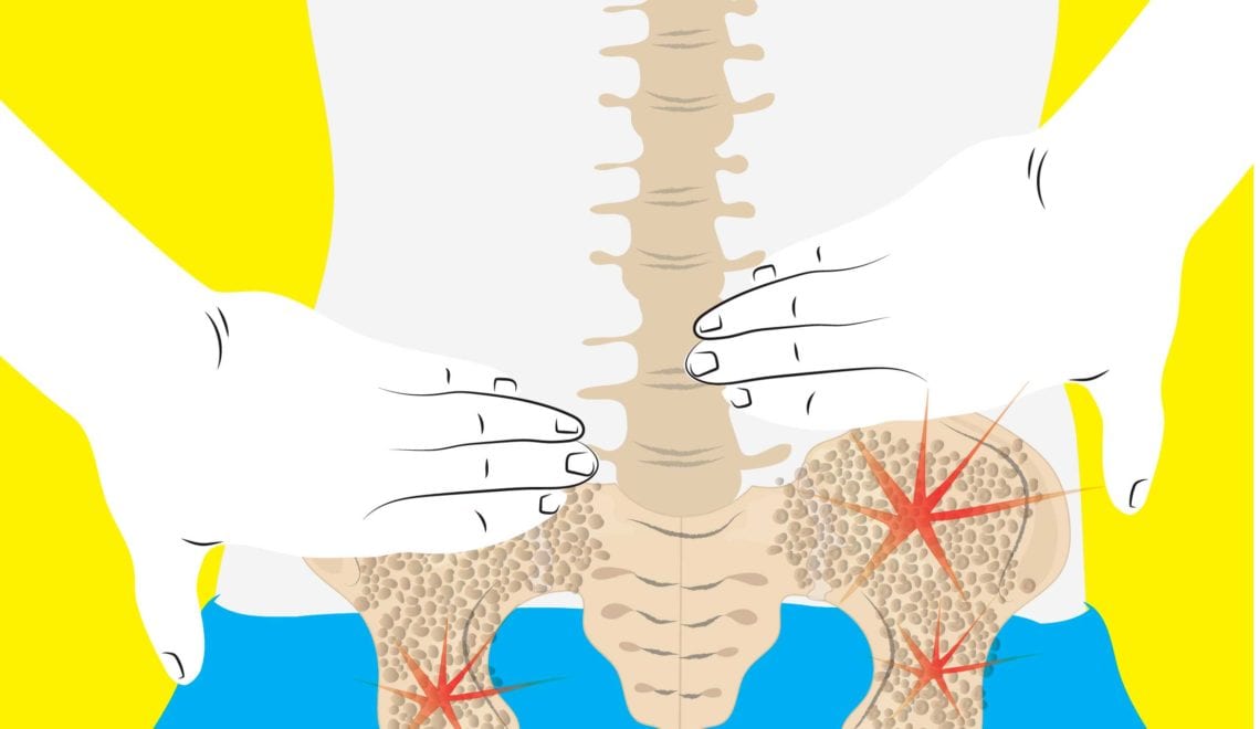 Cartoon shows the spine and hips through the lower back. The hips have red stars indicating back pain