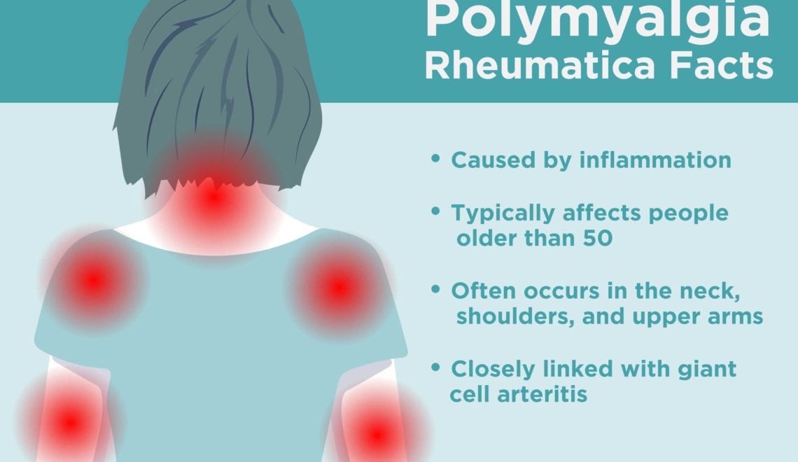 Polymyalgia Rheumatica Facts