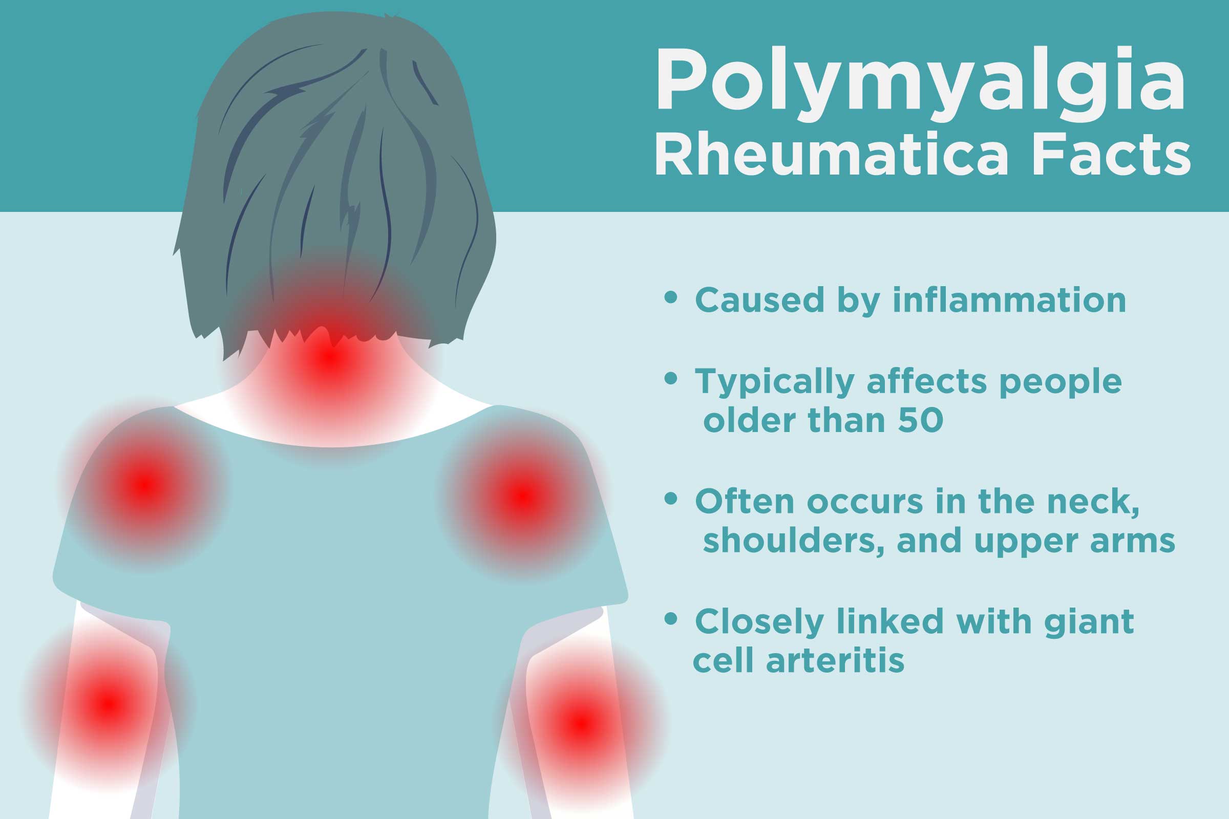 What Is Polymyalgia Rheumatica? These Are The Signs You Could Have It