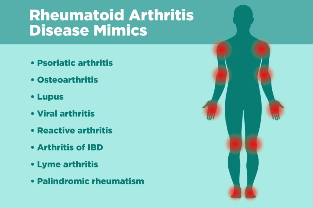 Diseases That Rheumatoid Arthritis Can Be Mistaken For