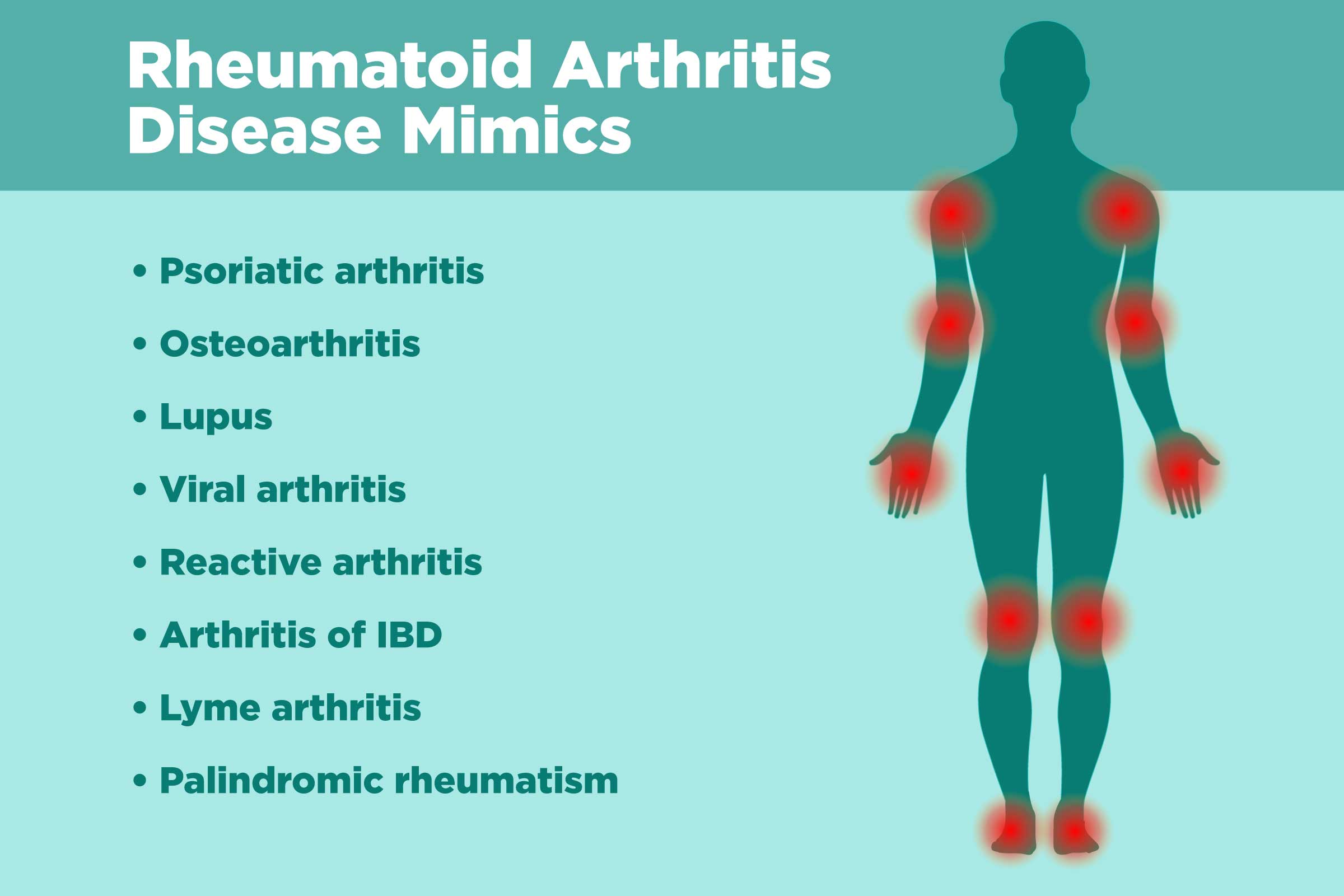 Diseases That Rheumatoid Arthritis Can Be Mistaken For   0419 RA Disease Mimics 