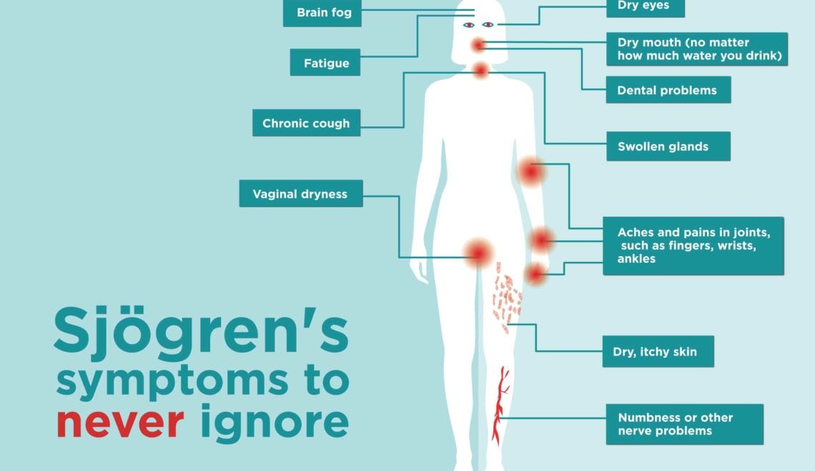 Sjogren's Syndrome Symptoms