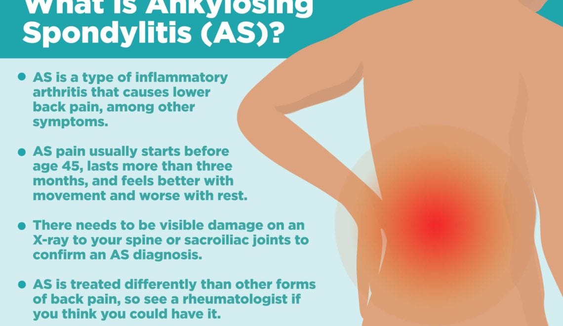 Infographic explaining what ankylosing spondylitis is