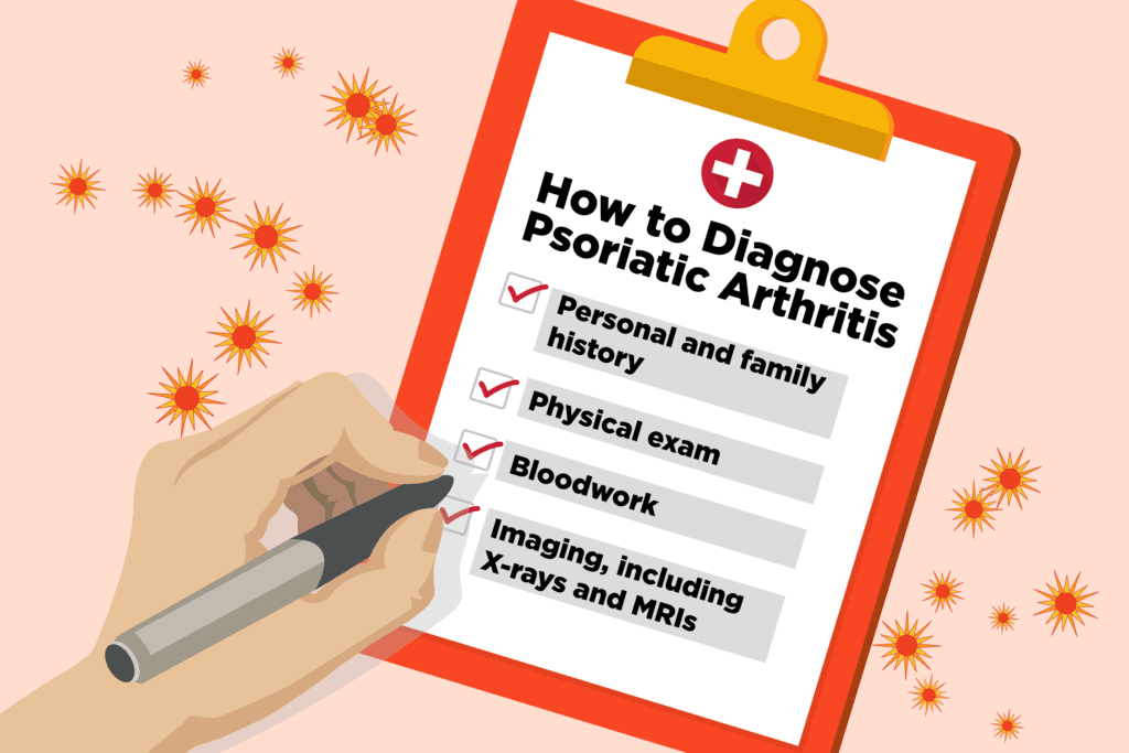 Diagnosticare l'artrite psoriasica