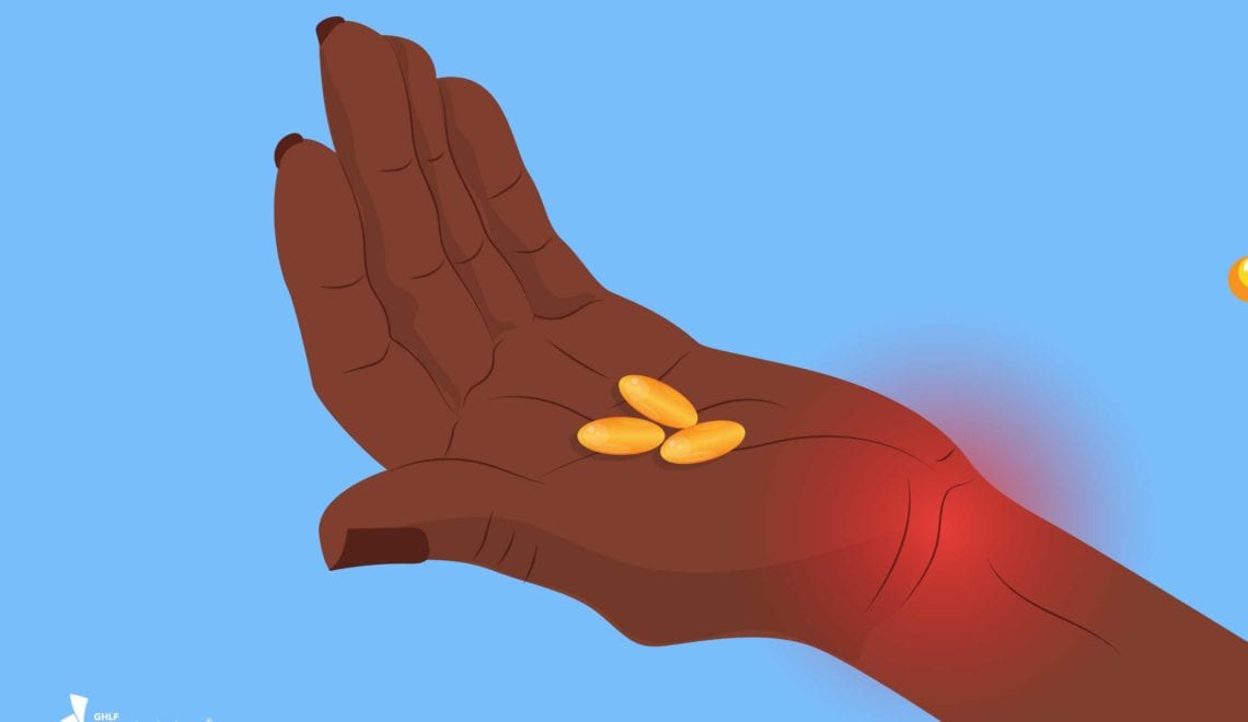 Omega-3 Supplements for Arthritis