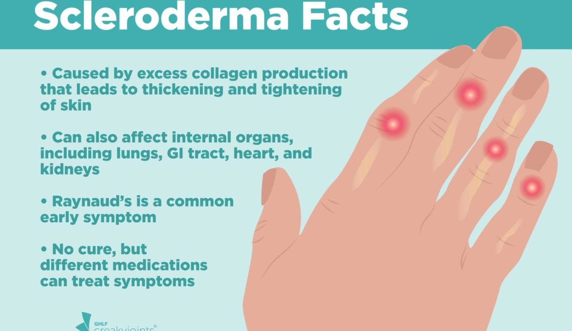 Scleroderma Facts