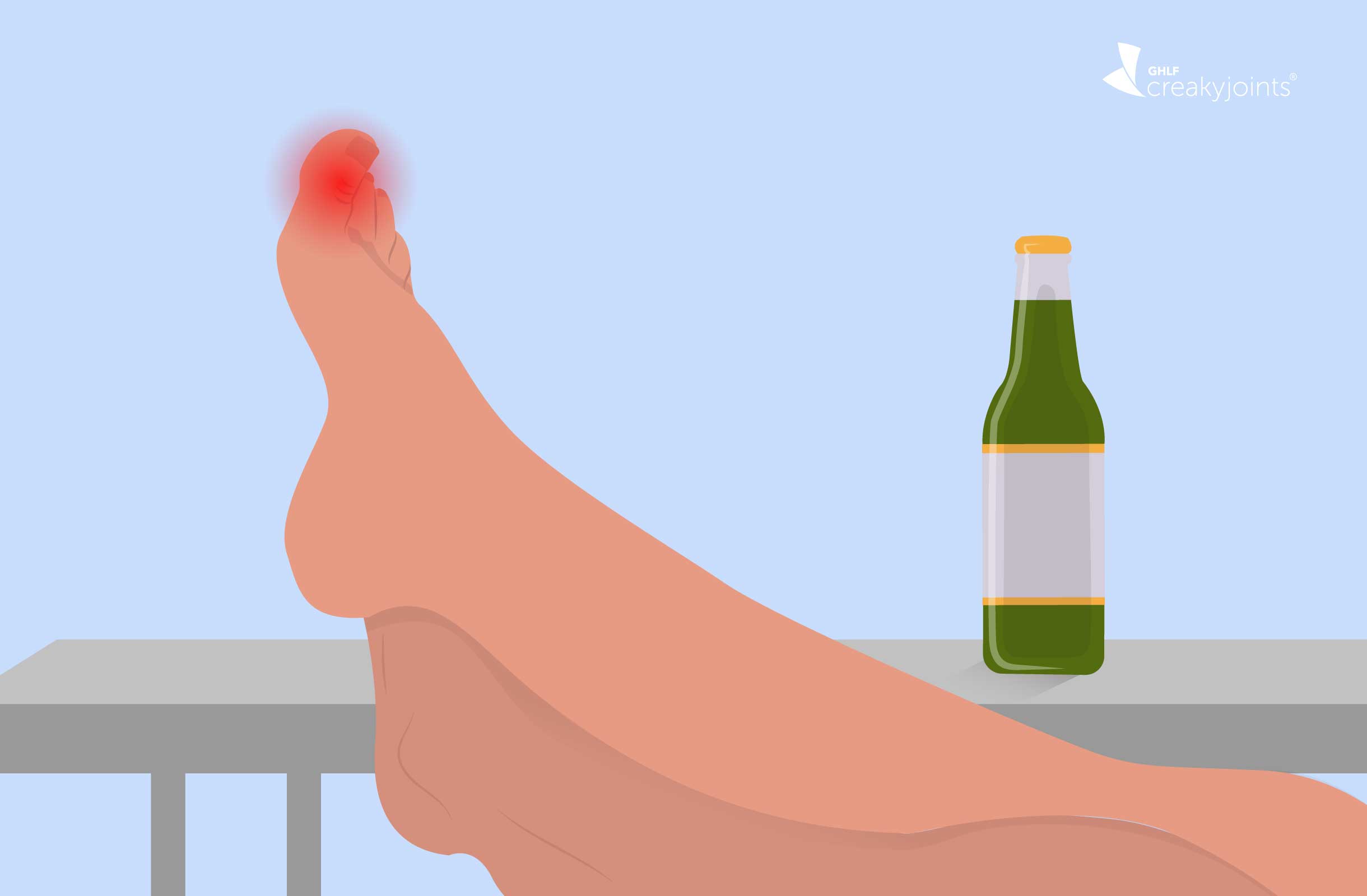 Sikker amerikansk dollar Tilståelse The Link Between Alcohol and Gout: Does Drinking Alcohol Affect Gout?