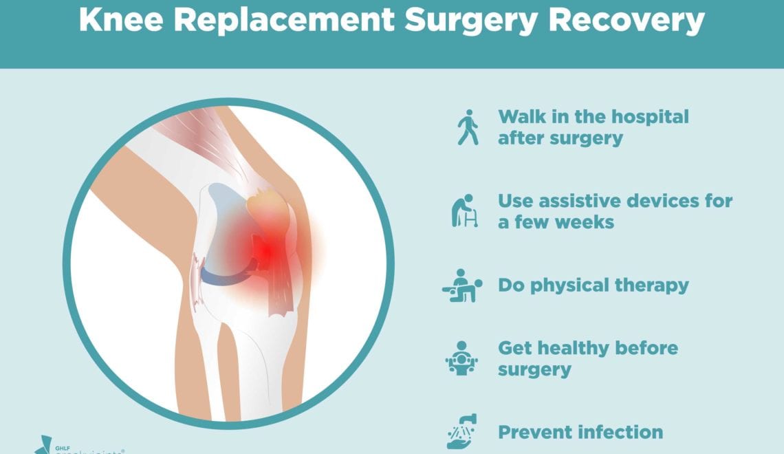 Knee Replacement Surgery Recovery