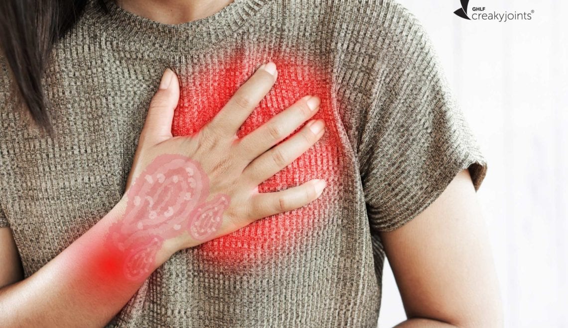 Psoriatic Arthritis and Heart Disease