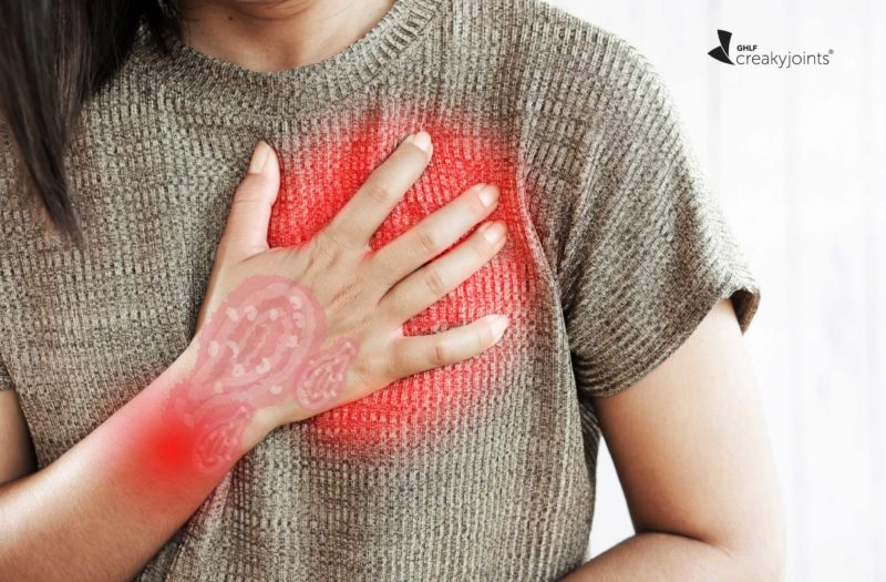 Psoriatic Arthritis and Heart Disease