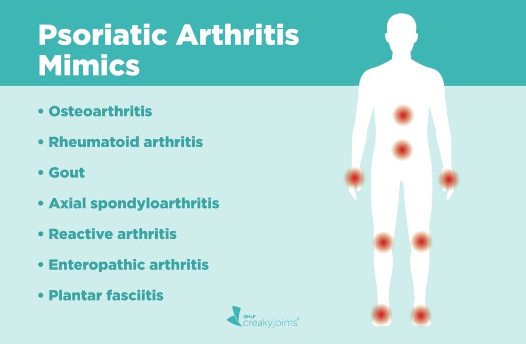 rheumatoid arthritis differential diagnosis)