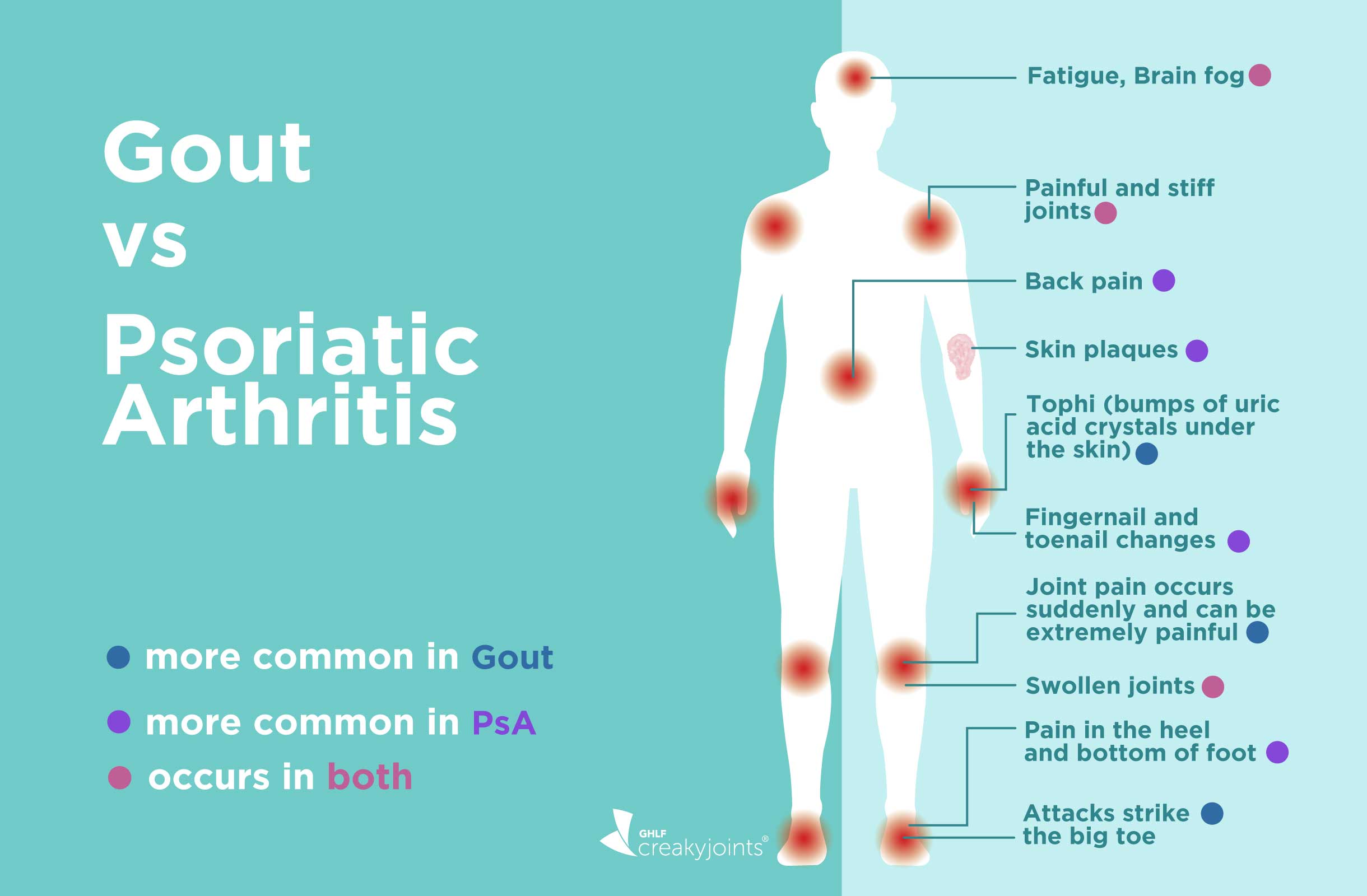 Gout Vs Psoriatic Arthritis Differences In Symptoms And Treatments   1219 Gout Vs PsA Logo 