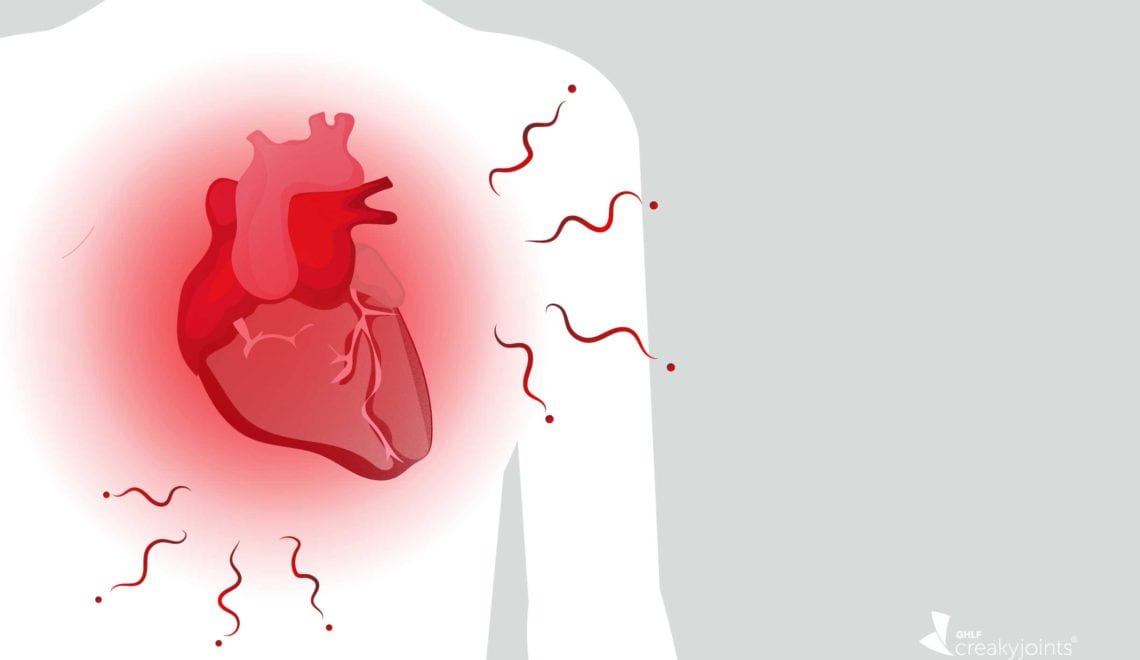 Heart Inflammation Arthritis