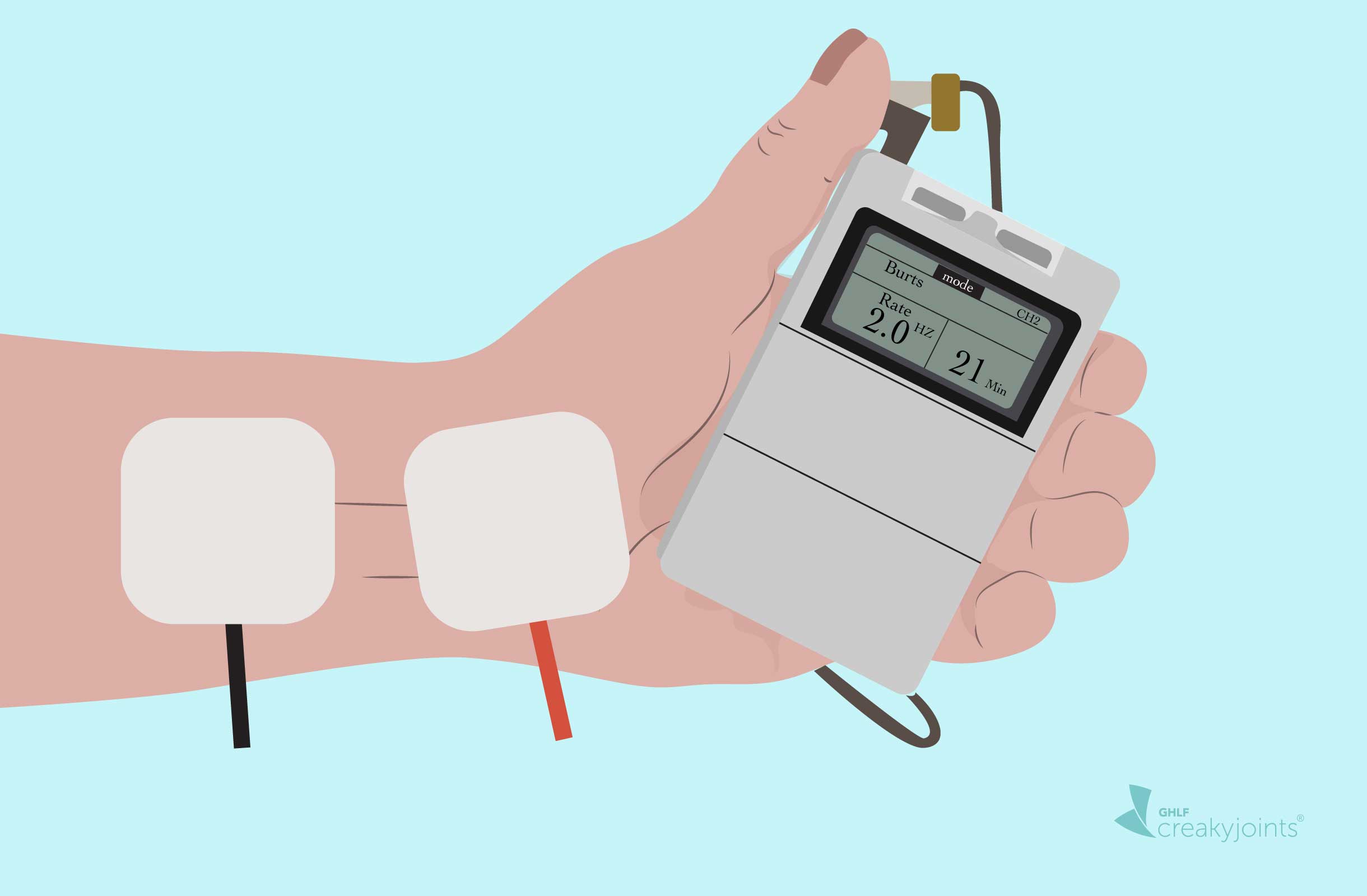 Transcutaneous Electric Nerve Stimulation (TENS) for Arthritis Pain