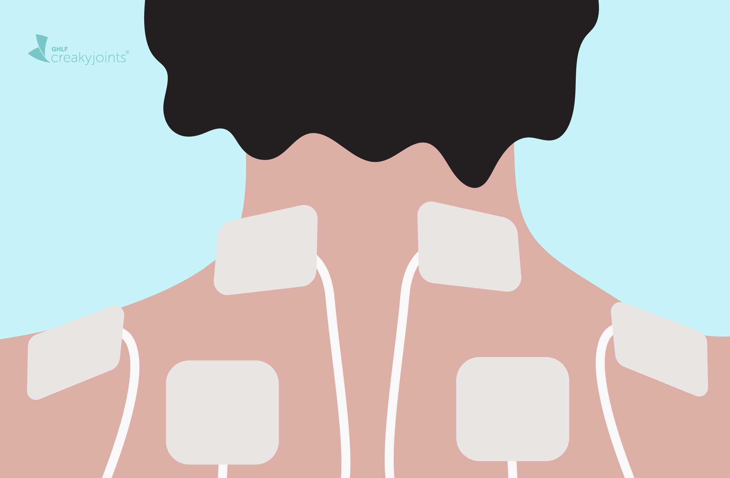 Transcutaneous Electrical Nerve Stimulation (TENS) - The Pain Community